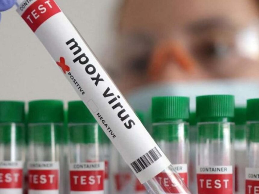 cas de Mpox