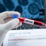 Mpox au Togo